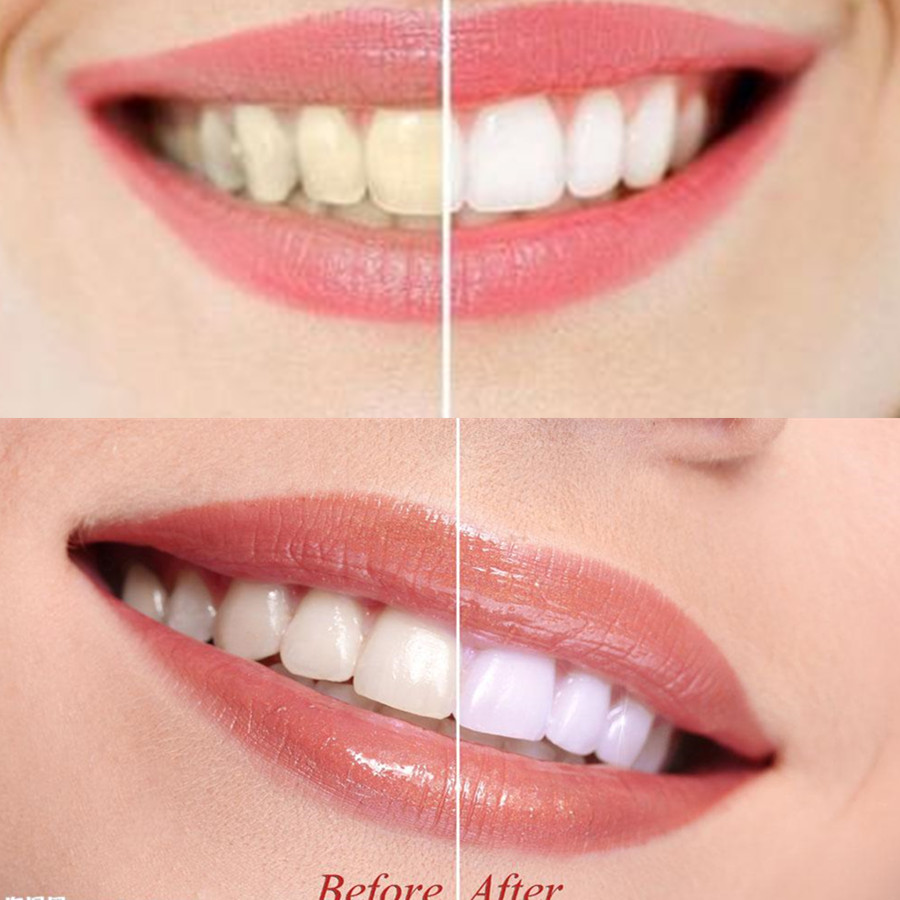Dentes de carvão vegetal de ba - Teeth Whitening Powder avaliação e preço