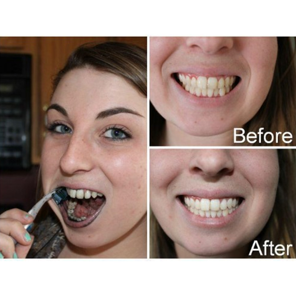 Dentes de carvão vegetal de ba - Teeth Whitening Powder avaliação e preço