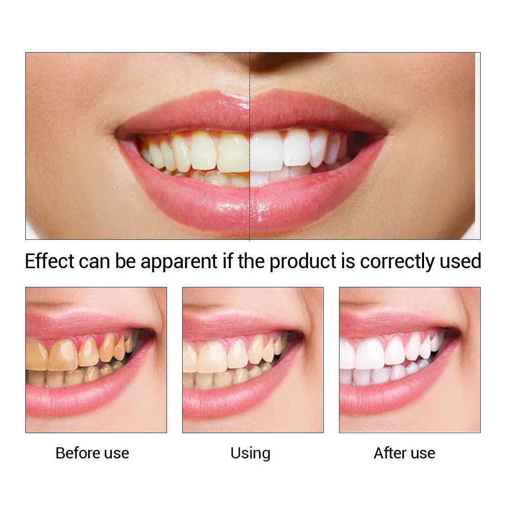 FTEENPLY Essência para claream - Teeth Whitening Natural avaliação e preço
