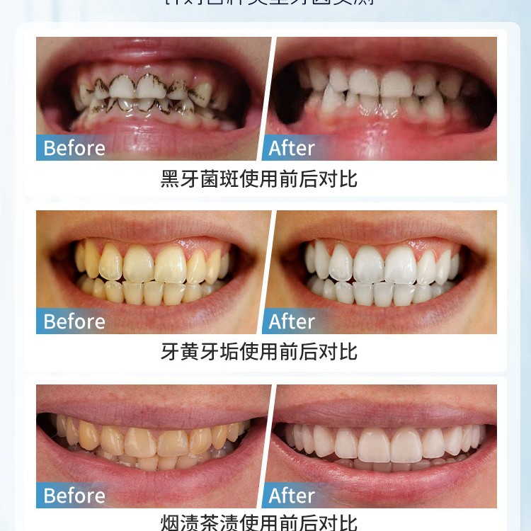 Escova manual japonesa para re - Teeth Whitening In Japan avaliação e preço